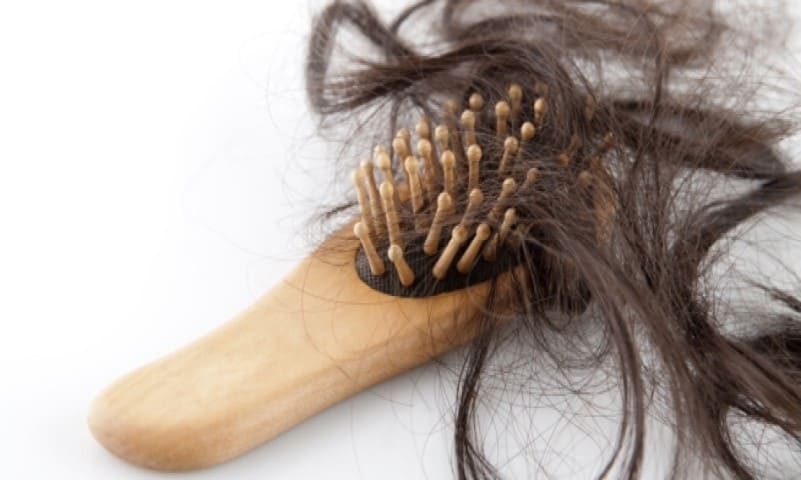 أسباب تساقط الشعر عند النساء وعلاجه .. ما هي اسباب سقوط الشعر بغزارة؟