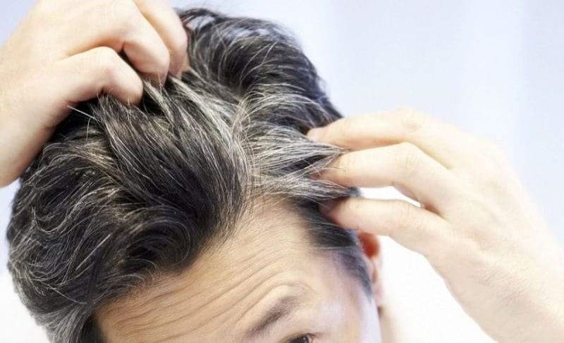 أسباب ظهور الشعر الأبيض في العشرينات .. تقليل الشعر الابيض بوصفات طبيعية