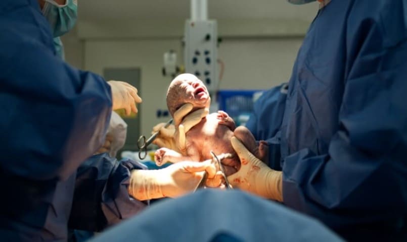 تجربتي مع الولادة القيصرية .. متى تبدأ العلاقة الحميمة بعد الولادة القيصرية؟